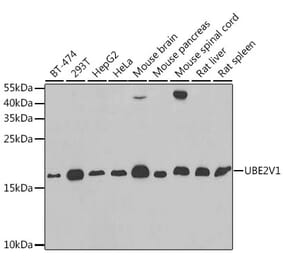 Western Blot - Anti-UBE2V1 Antibody (A11955) - Antibodies.com