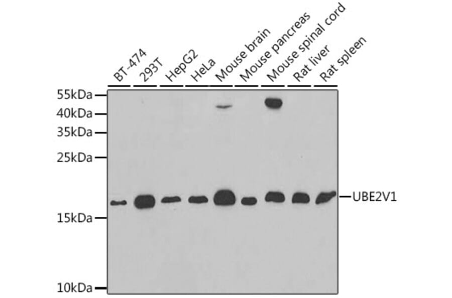 Western Blot - Anti-UBE2V1 Antibody (A11955) - Antibodies.com