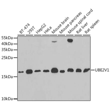 Western Blot - Anti-UBE2V1 Antibody (A11955) - Antibodies.com