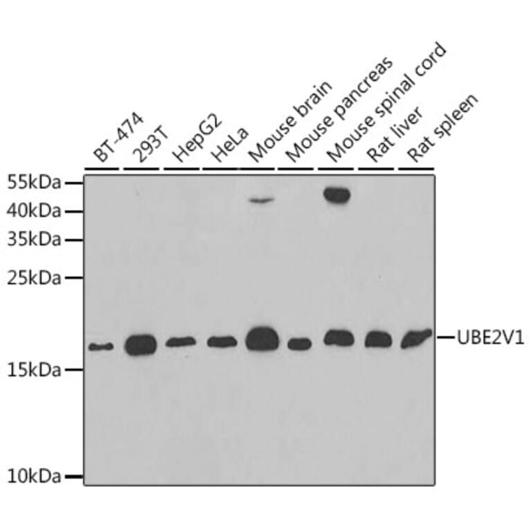 Western Blot - Anti-UBE2V1 Antibody (A11955) - Antibodies.com