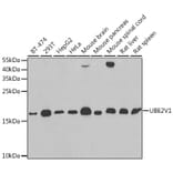 Western Blot - Anti-UBE2V1 Antibody (A11955) - Antibodies.com