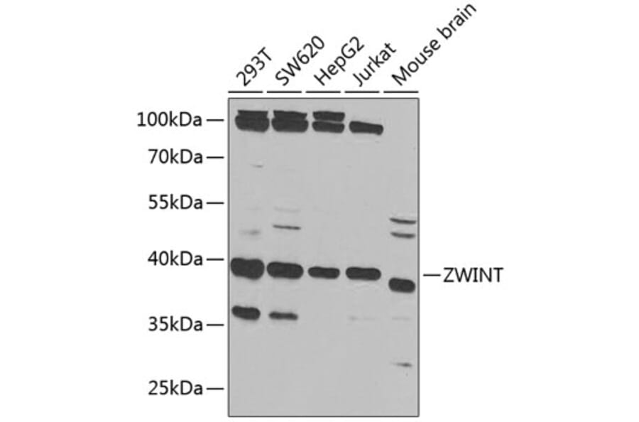 Western Blot - Anti-ZWINT Antibody (A11956) - Antibodies.com