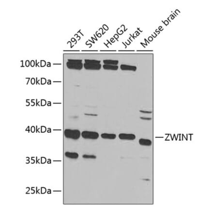 Western Blot - Anti-ZWINT Antibody (A11956) - Antibodies.com