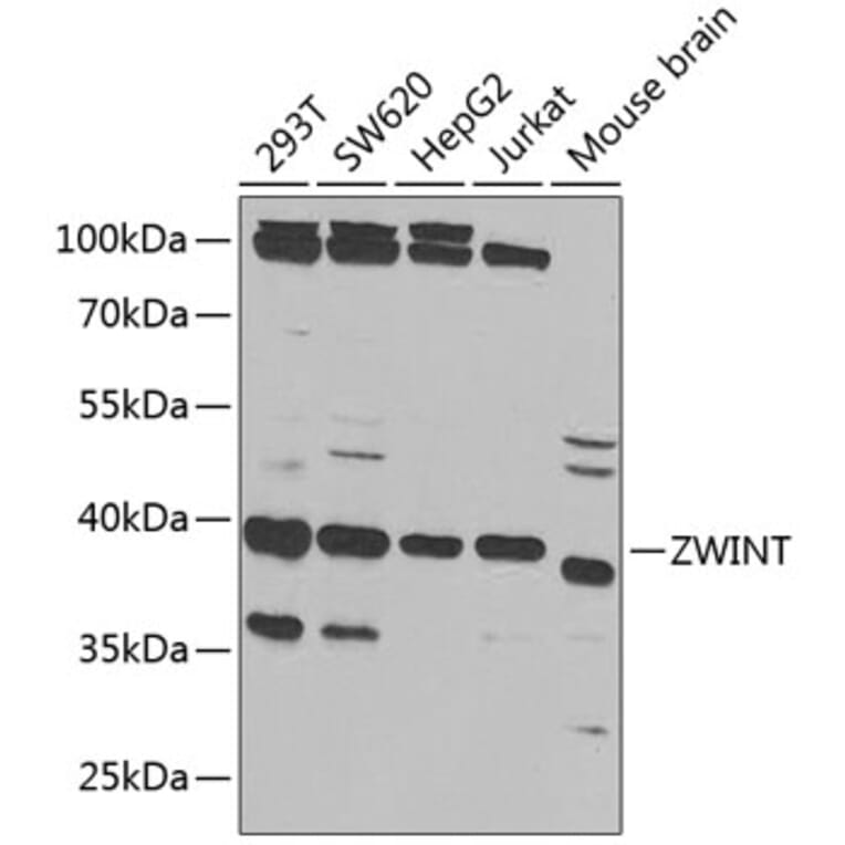 Western Blot - Anti-ZWINT Antibody (A11956) - Antibodies.com