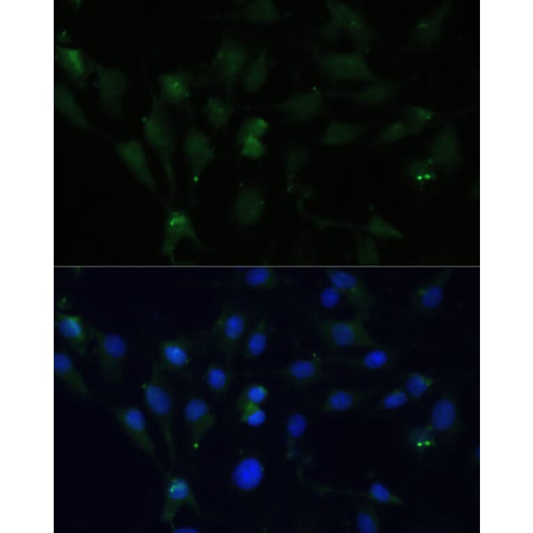 Immunofluorescence - Anti-ZWINT Antibody (A11956) - Antibodies.com