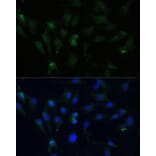 Immunofluorescence - Anti-ZWINT Antibody (A11956) - Antibodies.com