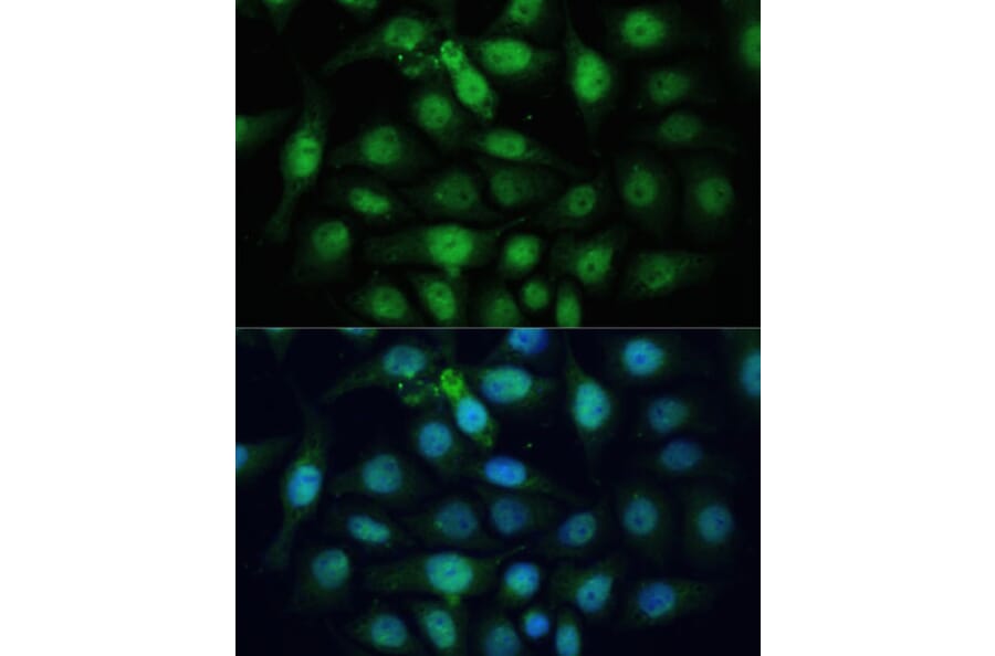 Immunofluorescence - Anti-ZWINT Antibody (A11956) - Antibodies.com