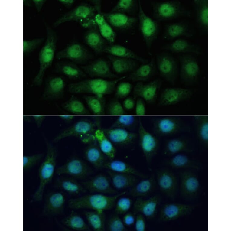 Immunofluorescence - Anti-ZWINT Antibody (A11956) - Antibodies.com