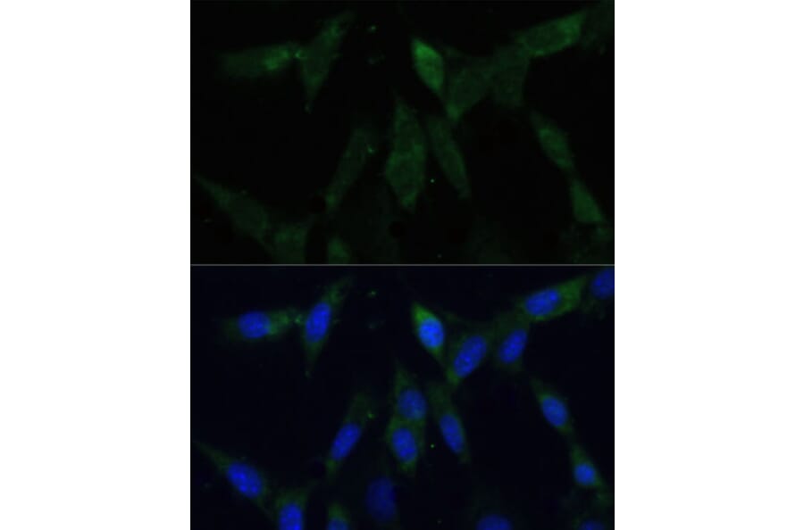 Immunofluorescence - Anti-ZWINT Antibody (A11956) - Antibodies.com