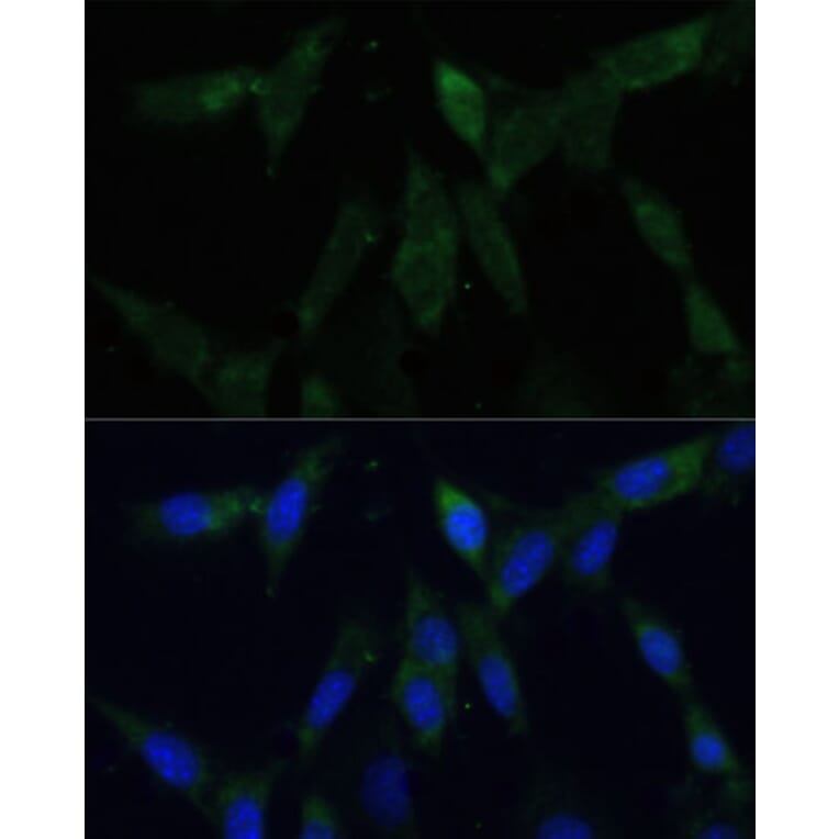 Immunofluorescence - Anti-ZWINT Antibody (A11956) - Antibodies.com