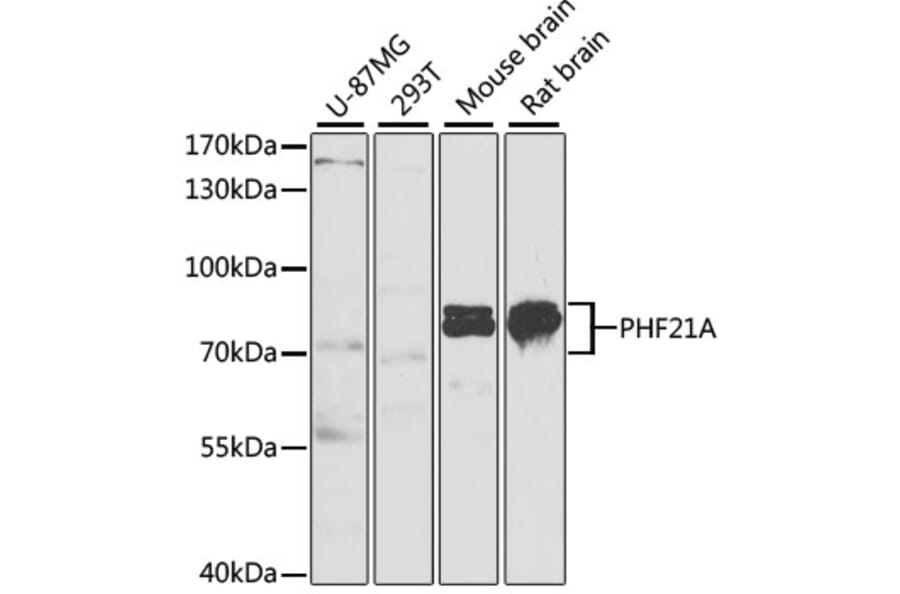 Western Blot - Anti-BHC80/PHF21A Antibody (A11957) - Antibodies.com