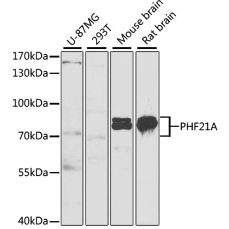 Western Blot - Anti-BHC80/PHF21A Antibody (A11957) - Antibodies.com