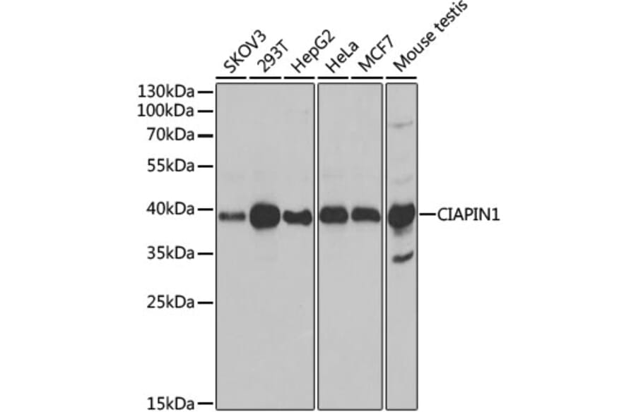 Western Blot - Anti-CIAPIN1 Antibody (A11958) - Antibodies.com