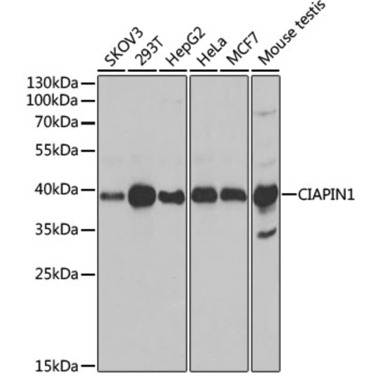 Western Blot - Anti-CIAPIN1 Antibody (A11958) - Antibodies.com