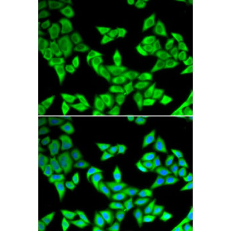 Immunofluorescence - Anti-CIAPIN1 Antibody (A11958) - Antibodies.com