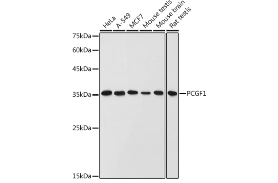 Western Blot - Anti-PCGF1 Antibody (A11959) - Antibodies.com