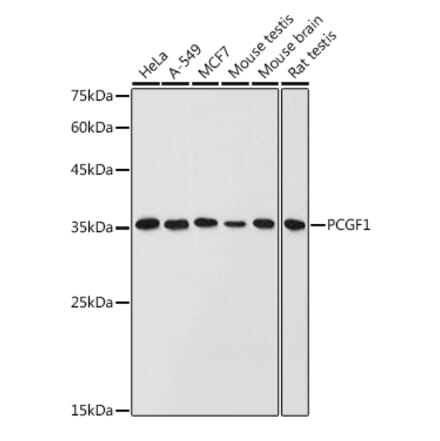 Western Blot - Anti-PCGF1 Antibody (A11959) - Antibodies.com