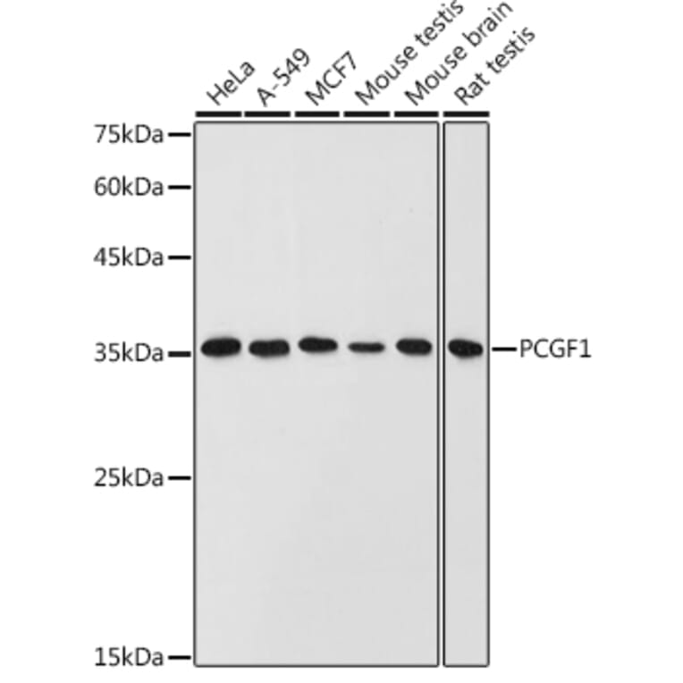 Western Blot - Anti-PCGF1 Antibody (A11959) - Antibodies.com