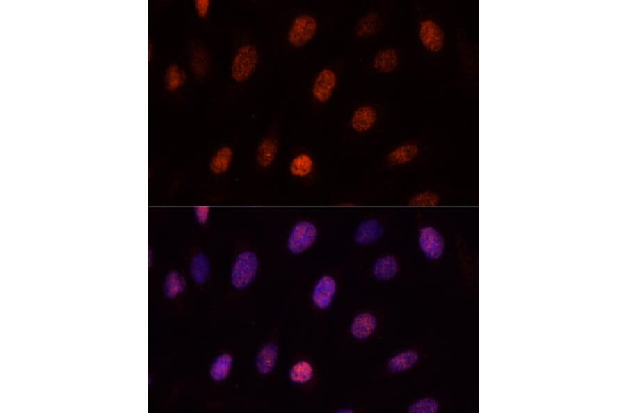 Immunofluorescence - Anti-PCGF1 Antibody (A11959) - Antibodies.com