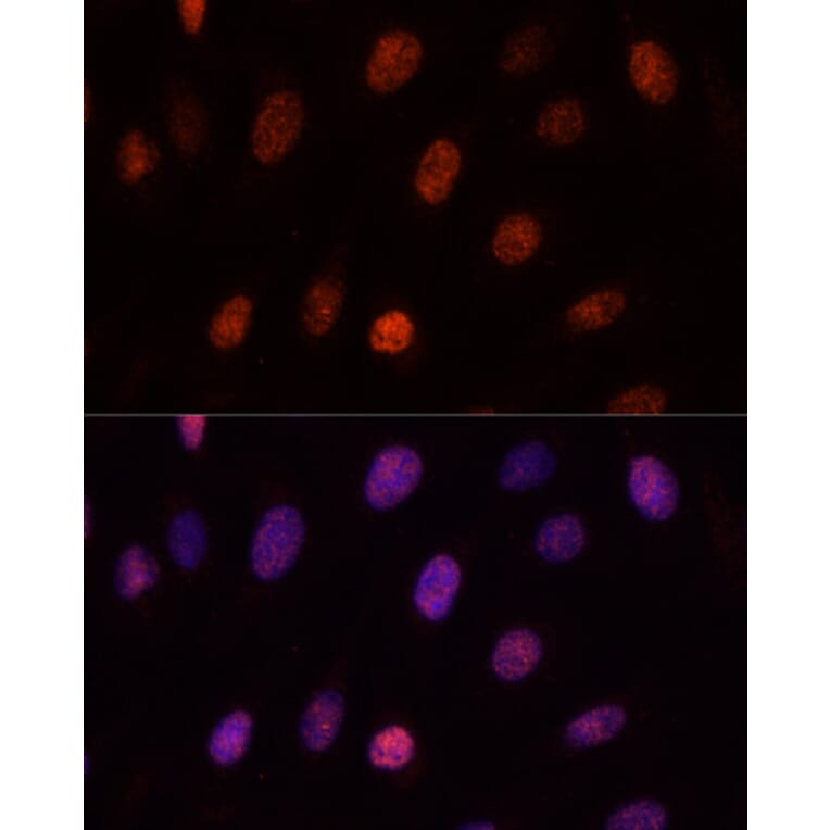Immunofluorescence - Anti-PCGF1 Antibody (A11959) - Antibodies.com