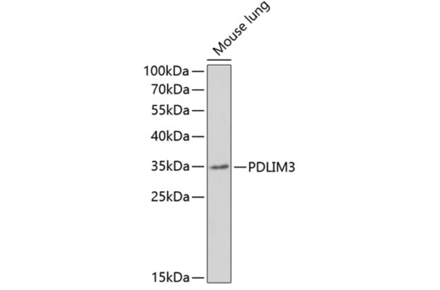 Western Blot - Anti-ALP Antibody (A11960) - Antibodies.com