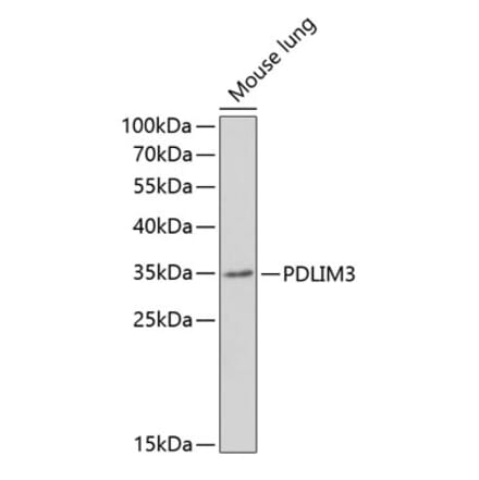 Western Blot - Anti-ALP Antibody (A11960) - Antibodies.com