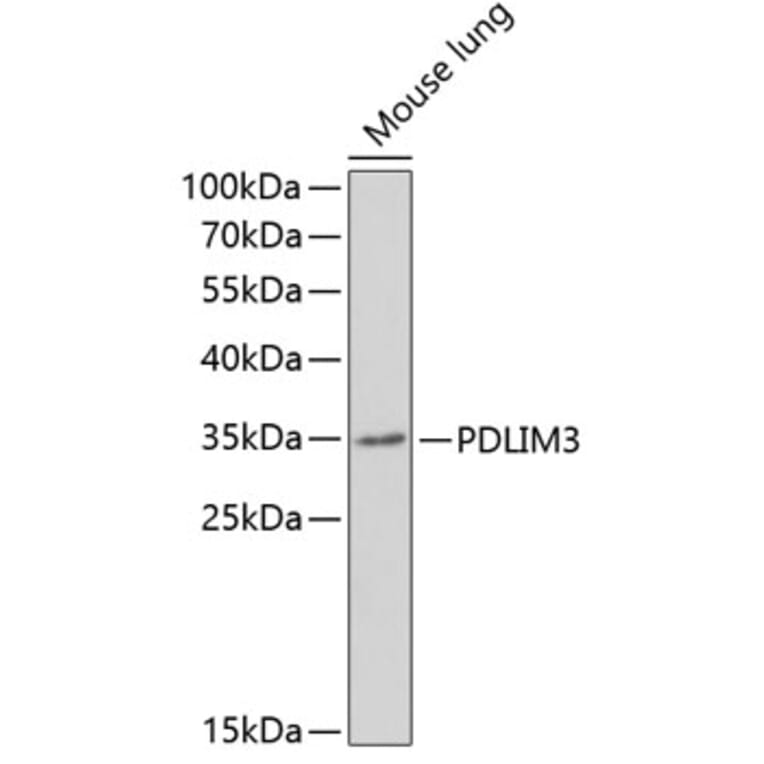 Western Blot - Anti-ALP Antibody (A11960) - Antibodies.com