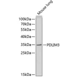 Western Blot - Anti-ALP Antibody (A11960) - Antibodies.com