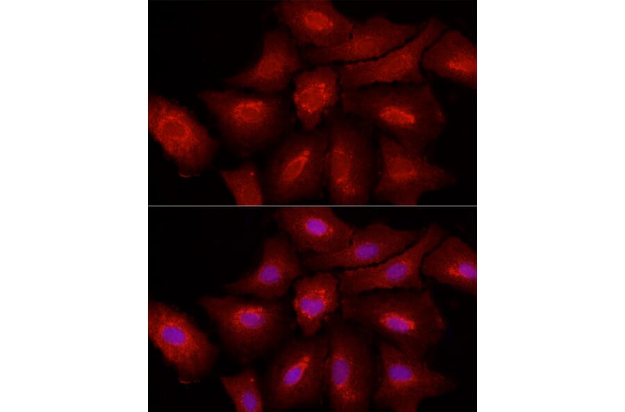 Immunofluorescence - Anti-Fibroblast activation protein, alpha Antibody (A11961) - Antibodies.com