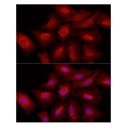 Immunofluorescence - Anti-Fibroblast activation protein, alpha Antibody (A11961) - Antibodies.com