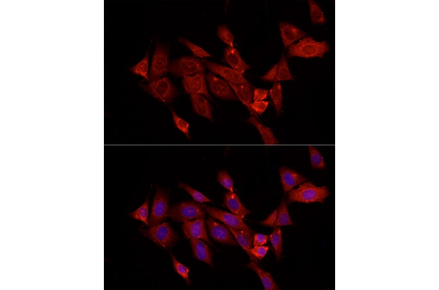 Immunofluorescence - Anti-Fibroblast activation protein, alpha Antibody (A11961) - Antibodies.com