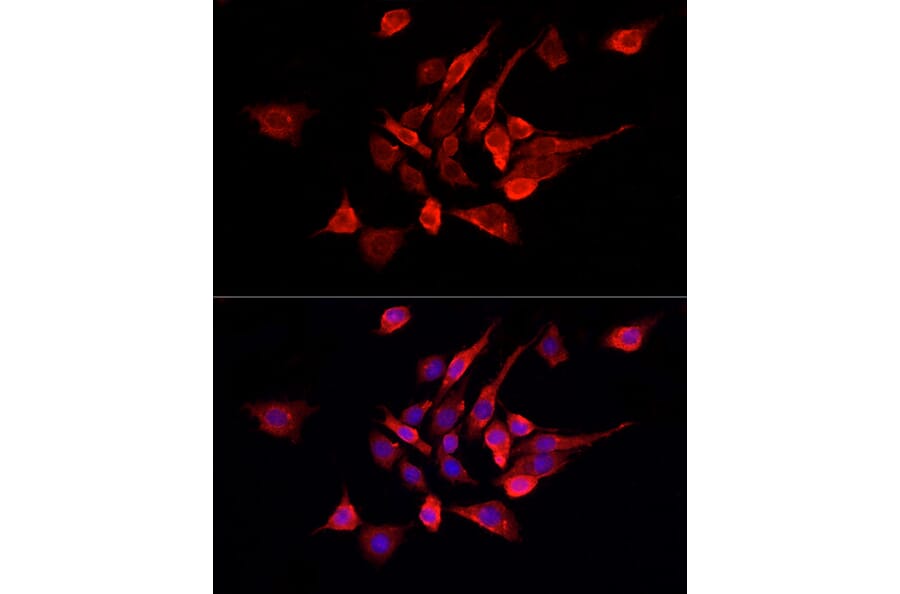 Immunofluorescence - Anti-Fibroblast activation protein, alpha Antibody (A11961) - Antibodies.com