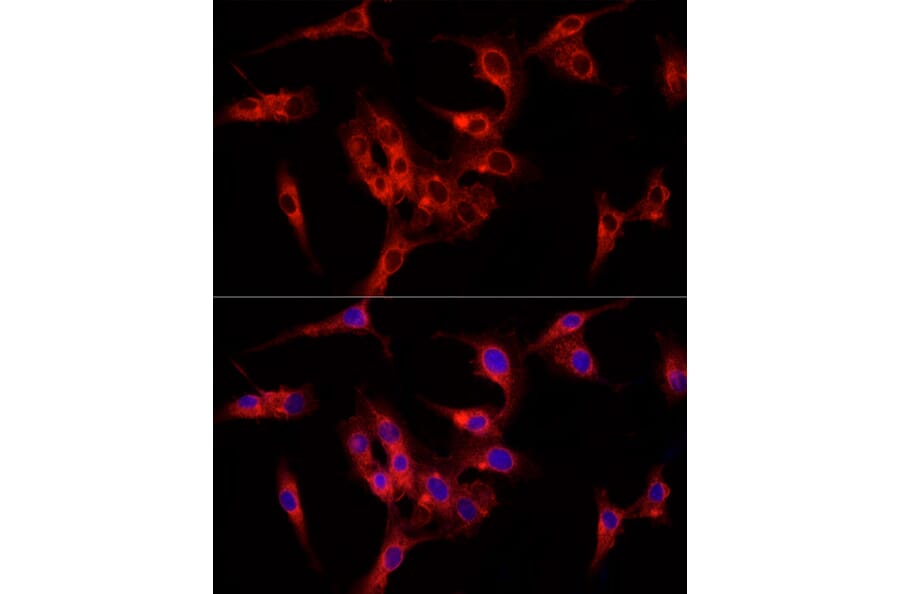 Immunofluorescence - Anti-Fibroblast activation protein, alpha Antibody (A11961) - Antibodies.com