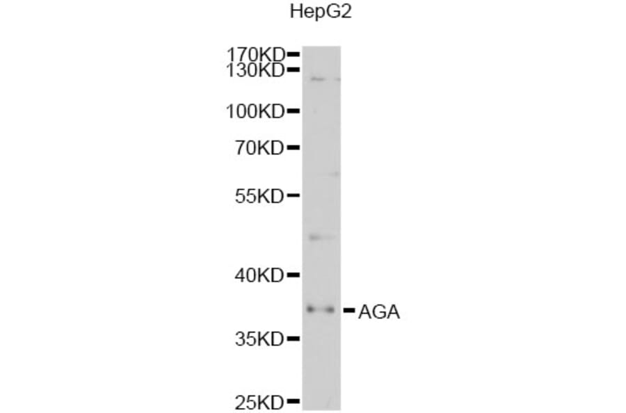 Western Blot - Anti-AGA Antibody (A6352) - Antibodies.com