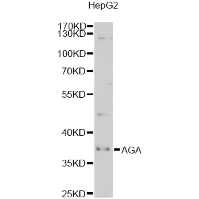Western Blot - Anti-AGA Antibody (A6352) - Antibodies.com