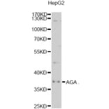 Western Blot - Anti-AGA Antibody (A6352) - Antibodies.com