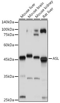 Anti-Argininosuccinate Lyase Antibody (A11964) | Antibodies.com