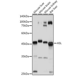 Western Blot - Anti-Argininosuccinate Lyase Antibody (A11964) - Antibodies.com
