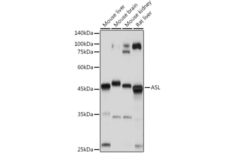 Western Blot - Anti-Argininosuccinate Lyase Antibody (A11964) - Antibodies.com
