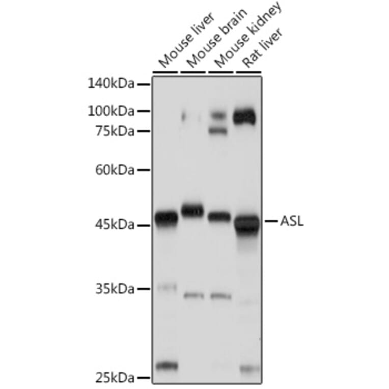 Western Blot - Anti-Argininosuccinate Lyase Antibody (A11964) - Antibodies.com