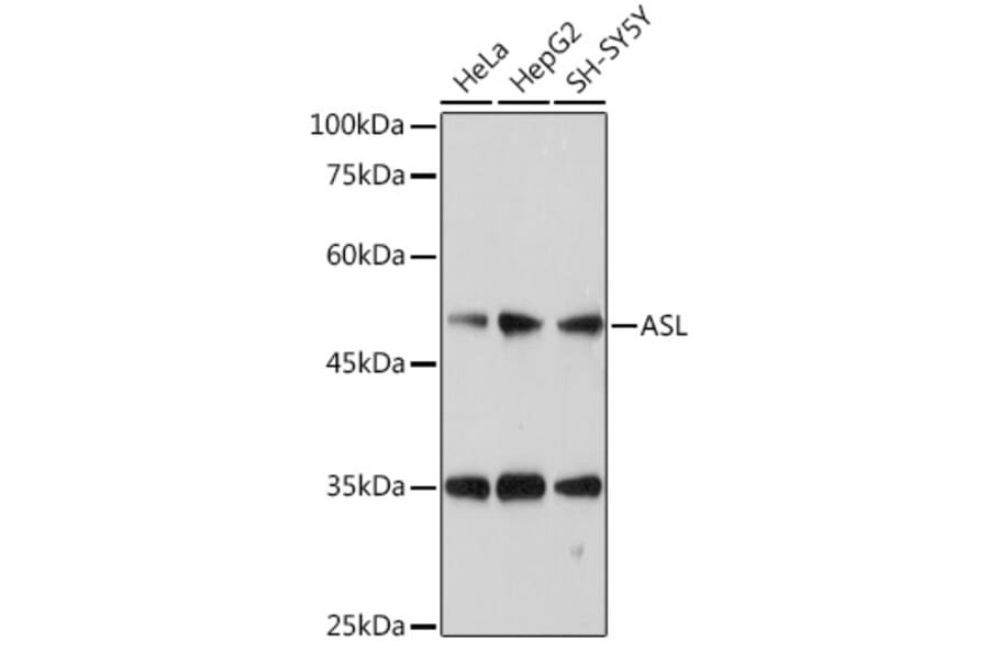 Western Blot - Anti-Argininosuccinate Lyase Antibody (A11964) - Antibodies.com