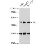 Western Blot - Anti-Argininosuccinate Lyase Antibody (A11964) - Antibodies.com