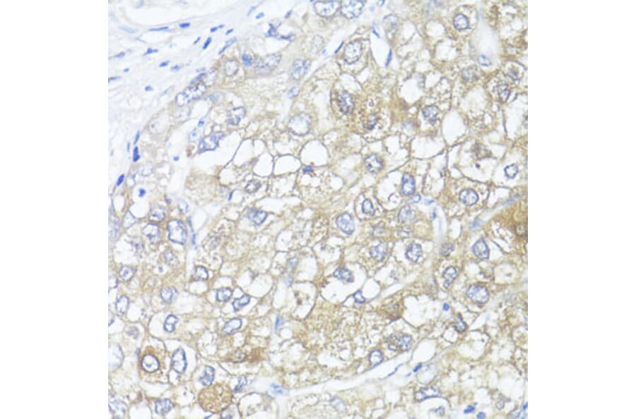 Immunohistochemistry - Anti-Argininosuccinate Lyase Antibody (A11964) - Antibodies.com