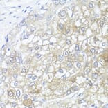 Immunohistochemistry - Anti-Argininosuccinate Lyase Antibody (A11964) - Antibodies.com