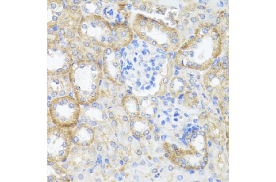 Immunohistochemistry - Anti-Argininosuccinate Lyase Antibody (A11964) - Antibodies.com