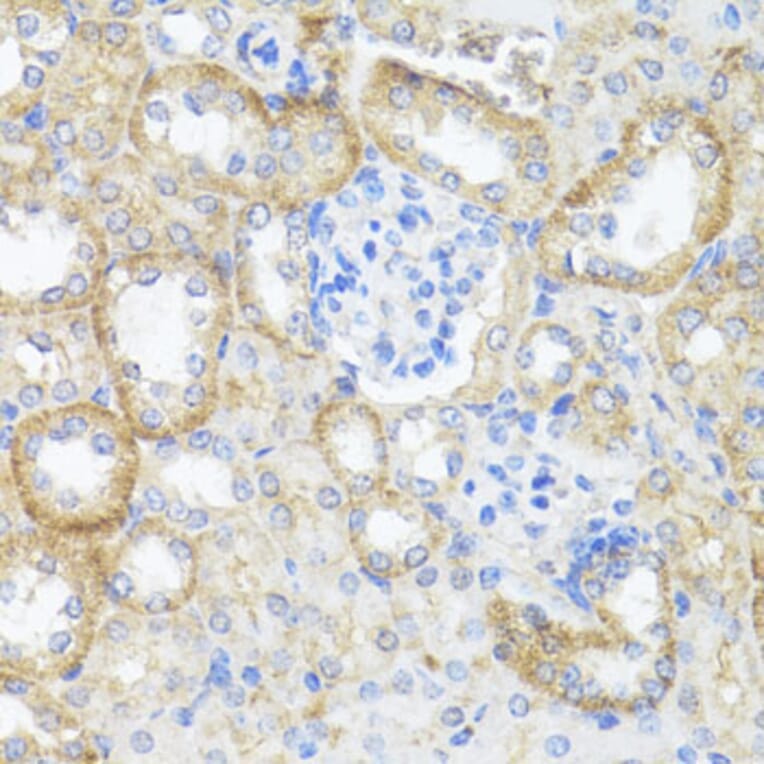 Immunohistochemistry - Anti-Argininosuccinate Lyase Antibody (A11964) - Antibodies.com