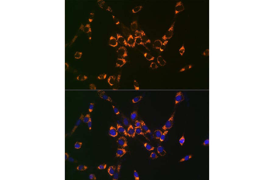 Immunofluorescence - Anti-Argininosuccinate Lyase Antibody (A11964) - Antibodies.com