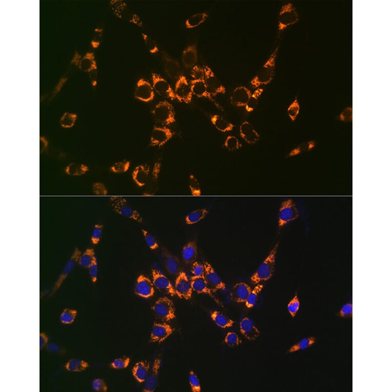 Immunofluorescence - Anti-Argininosuccinate Lyase Antibody (A11964) - Antibodies.com