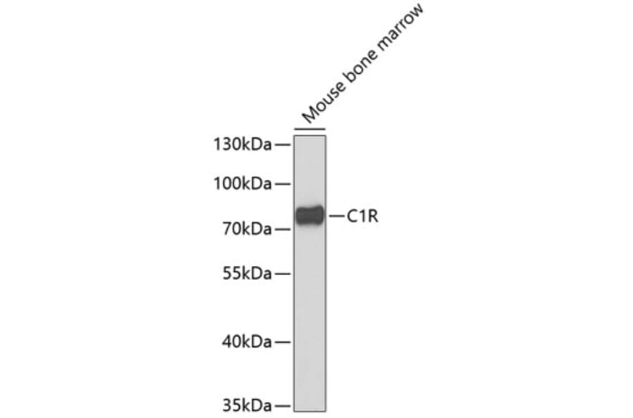 Western Blot - Anti-C1R Antibody (A6360) - Antibodies.com