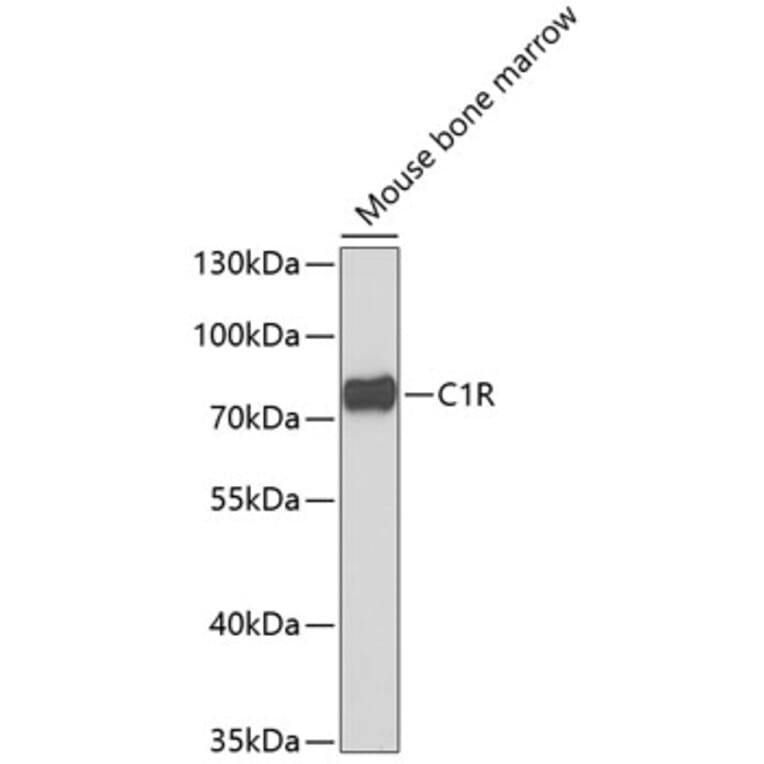 Western Blot - Anti-C1R Antibody (A6360) - Antibodies.com